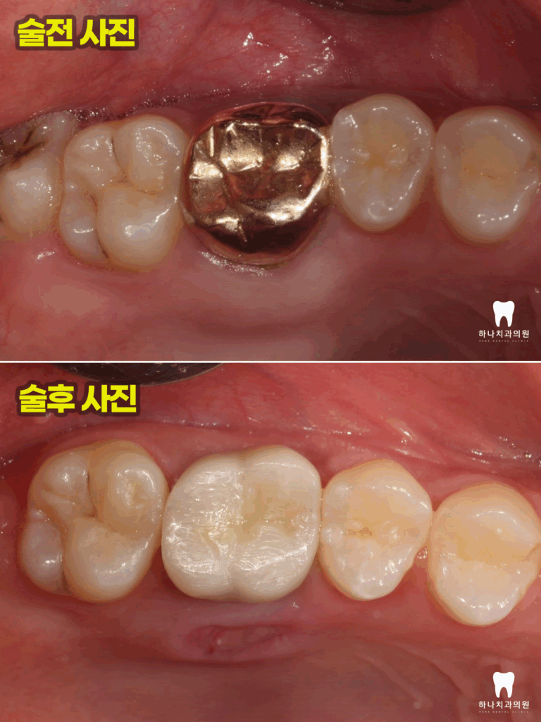 울산삼산동치과 