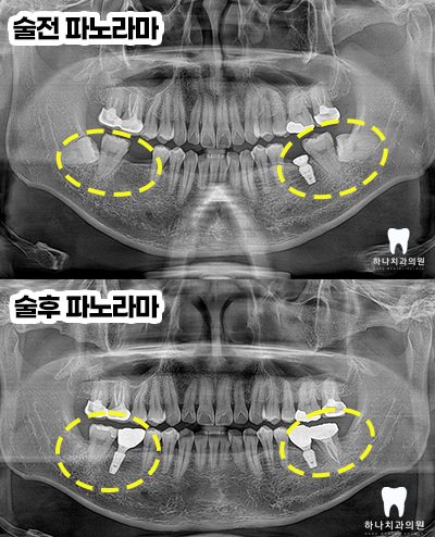 울산신정동치과 