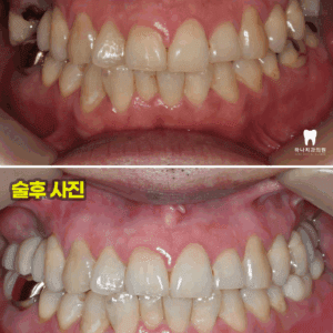 울산달동하나치과