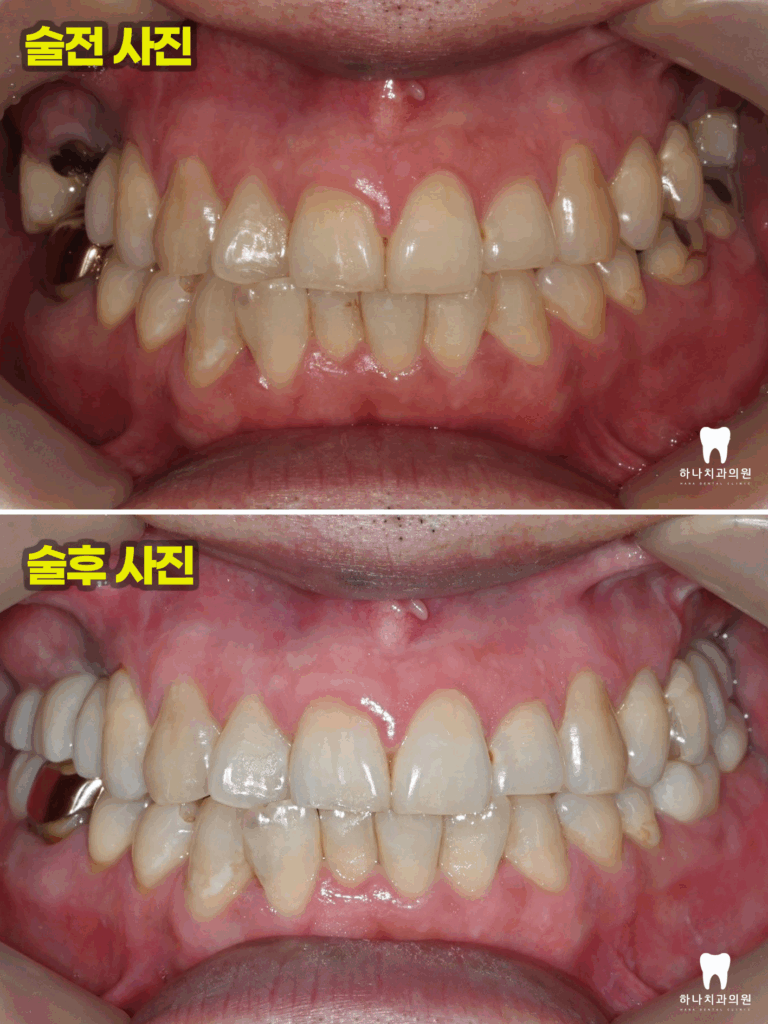 울산달동하나치과 