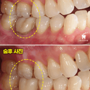 울산삼산동치과