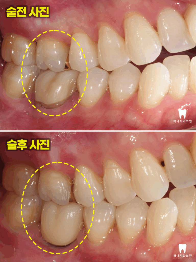 울산삼산동치과 
