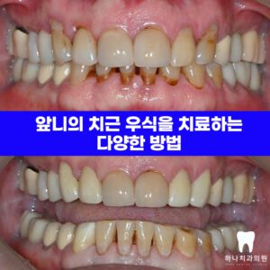 울산달동하나치과