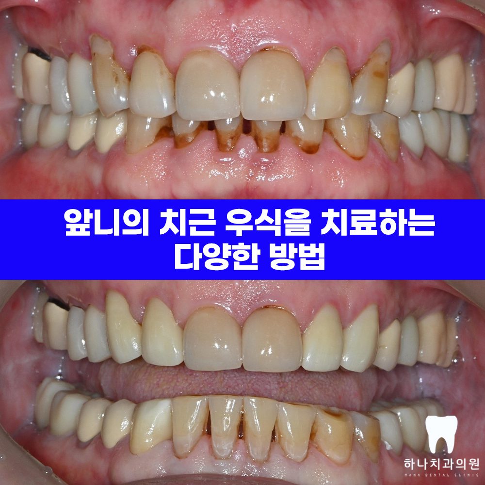 울산달동하나치과 