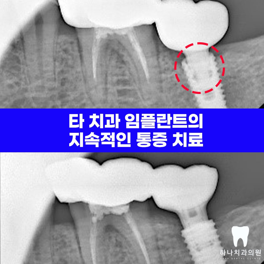 울산치과추천