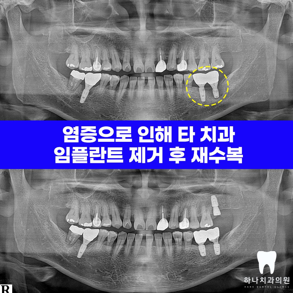 울산삼산동치과 