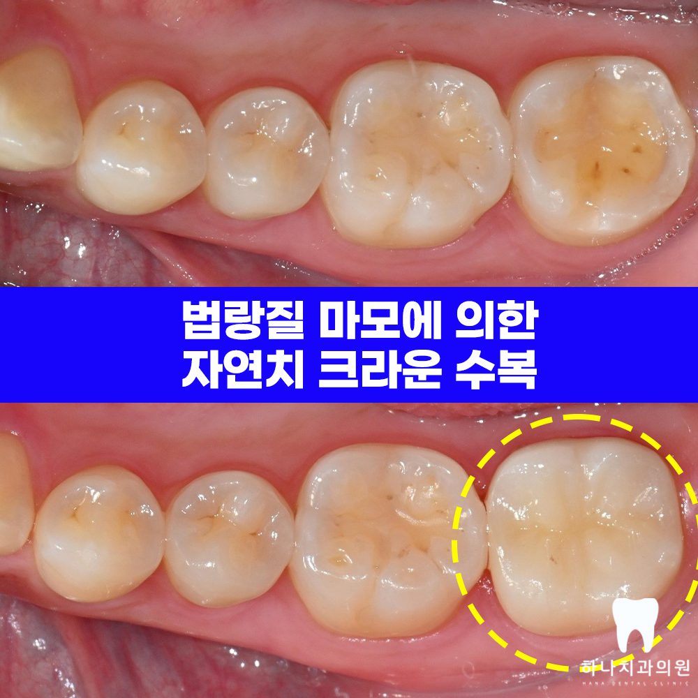 울산달동하나치과 