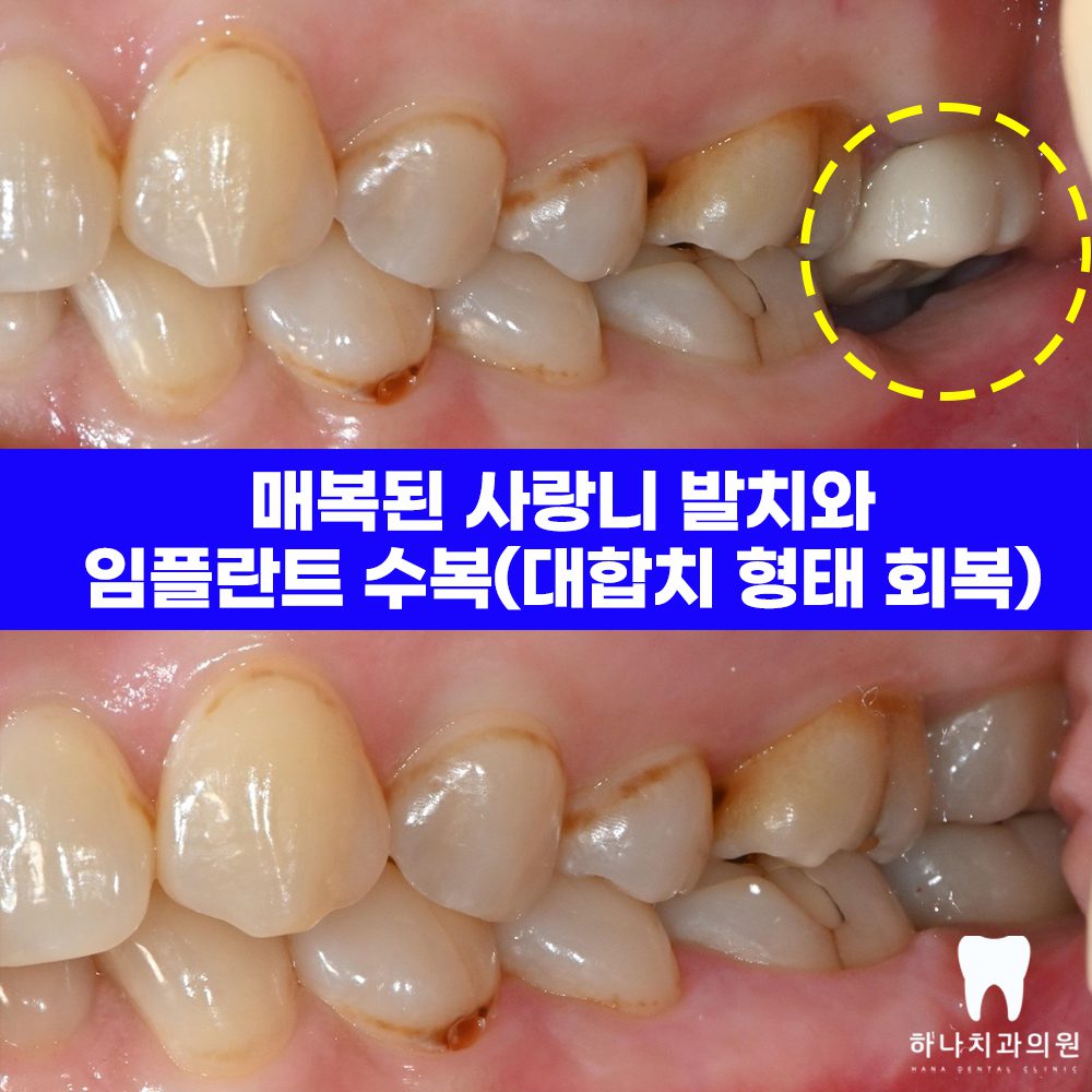 울산삼산동치과 