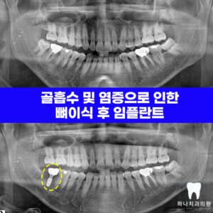 울산달동하나치과