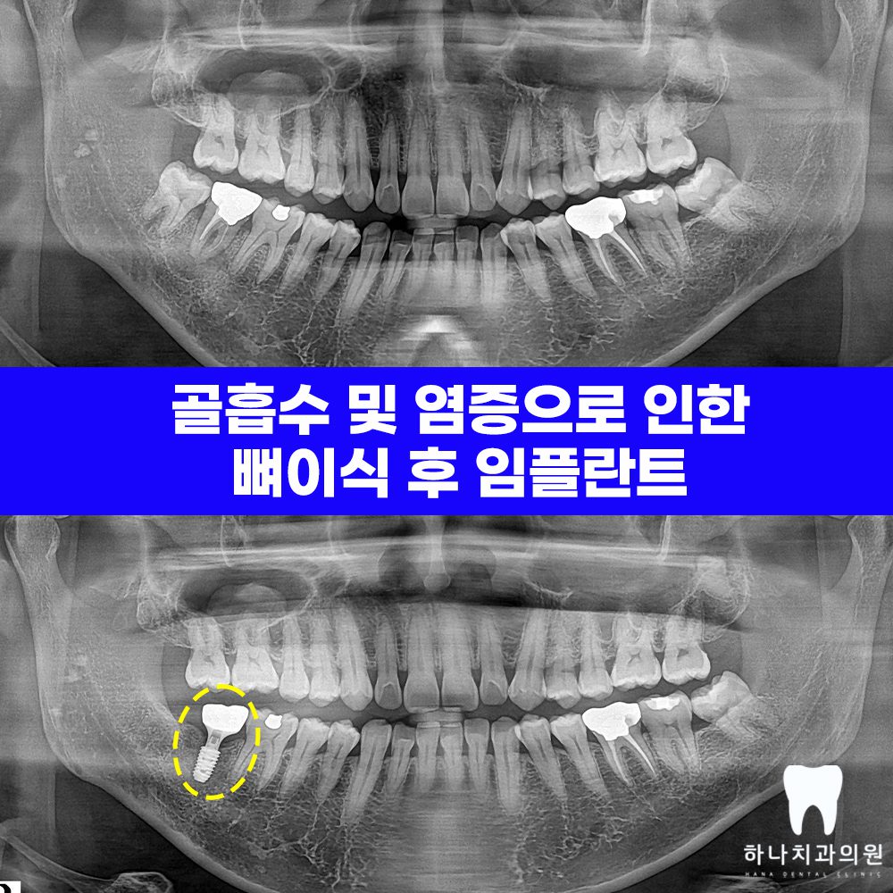 울산달동하나치과 