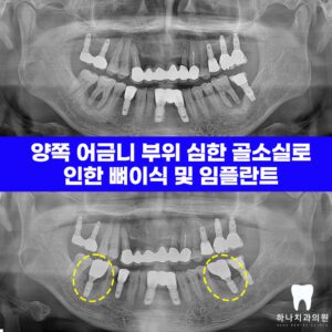 울산삼산동치과