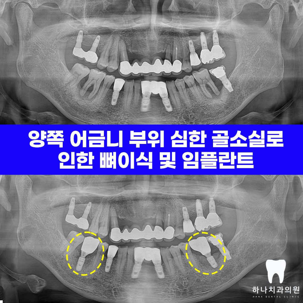 울산삼산동치과 