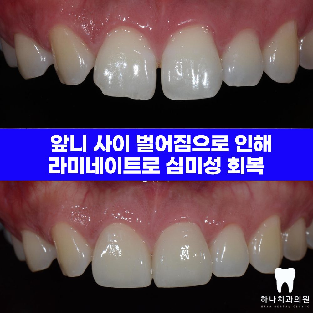 울산삼산동치과 