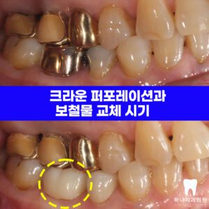 울산삼산동치과