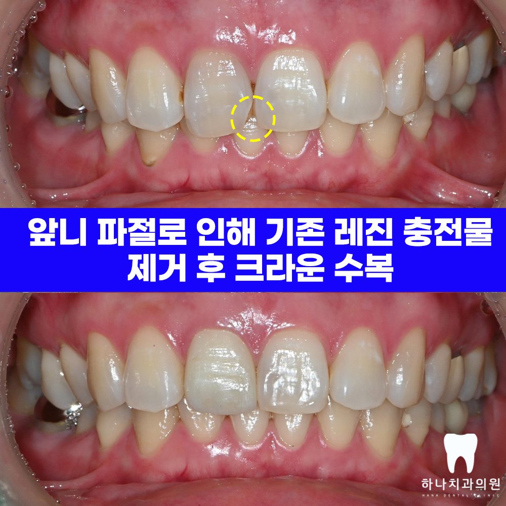 울산삼산동치과 