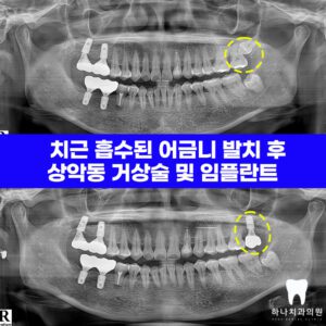 울산삼산동치과