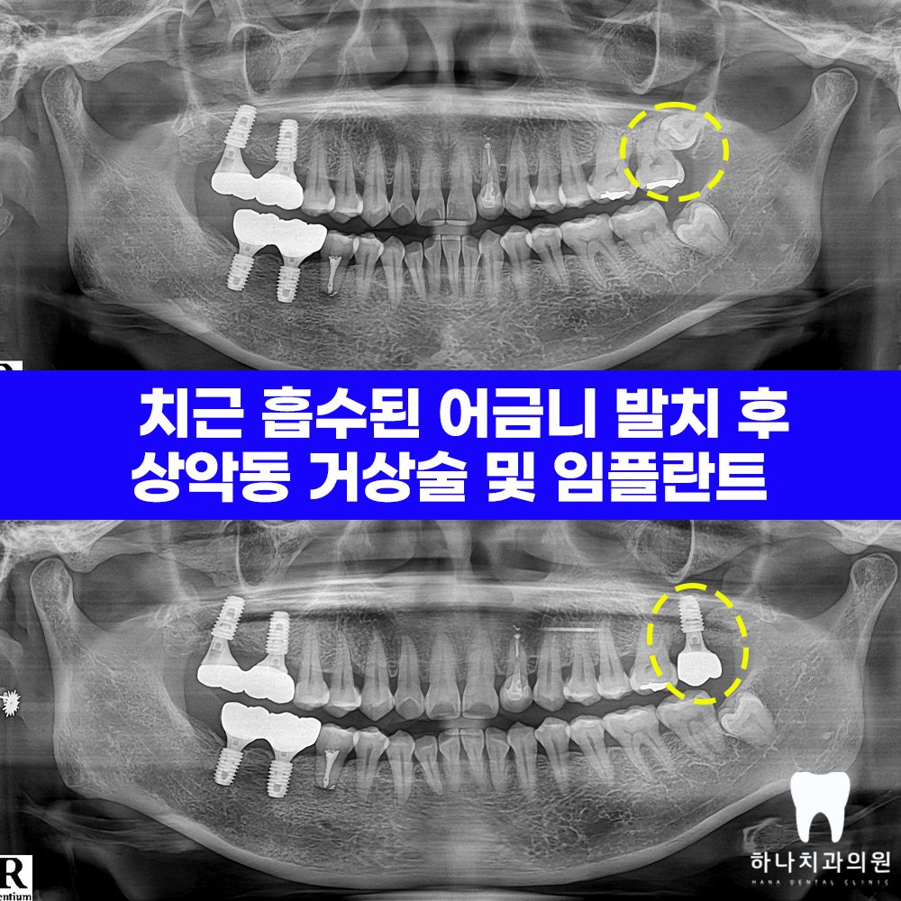울산삼산동치과 