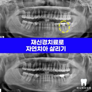 울산삼산동치과