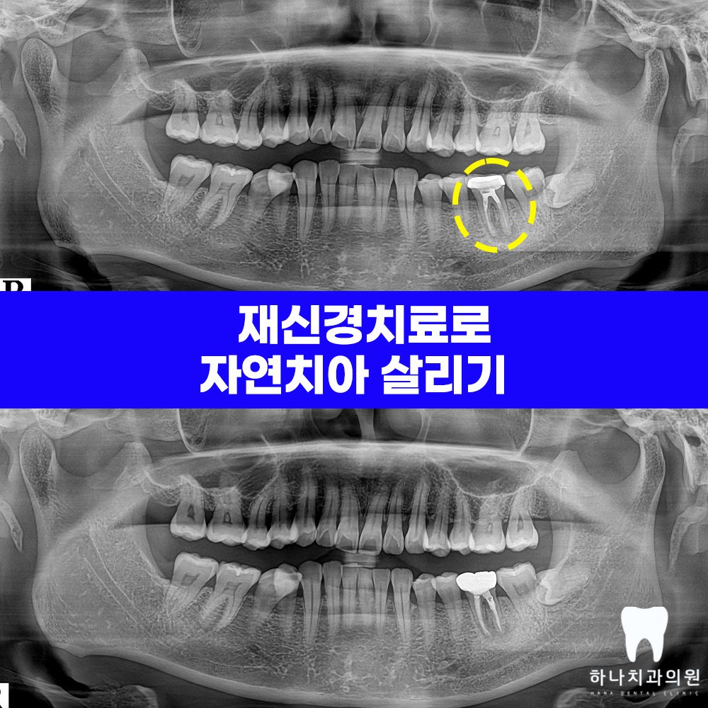 울산삼산동치과 