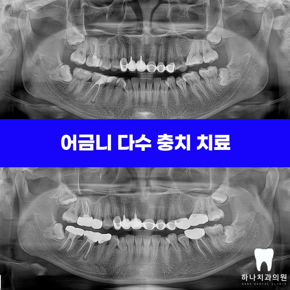 울산삼산동치과 