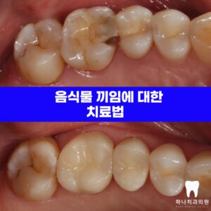 울산삼산동치과