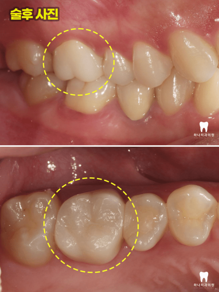 울산삼산동치과 
