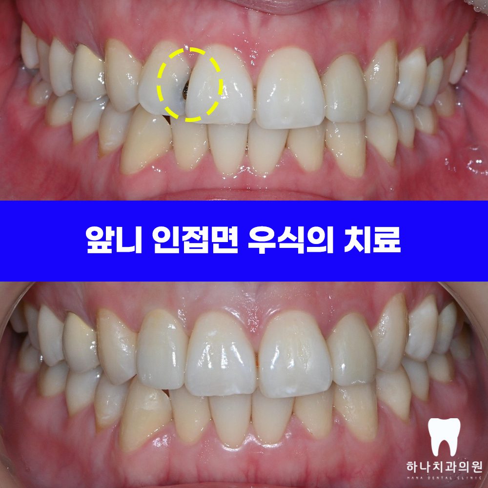 울산삼산동치과 