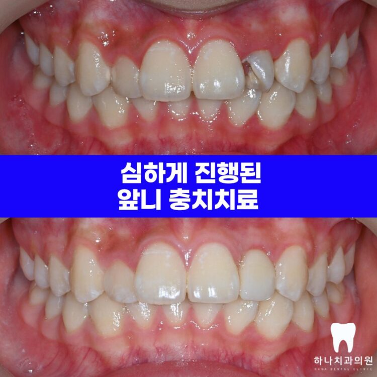울산치과 