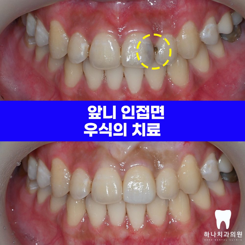 울산삼산동치과 