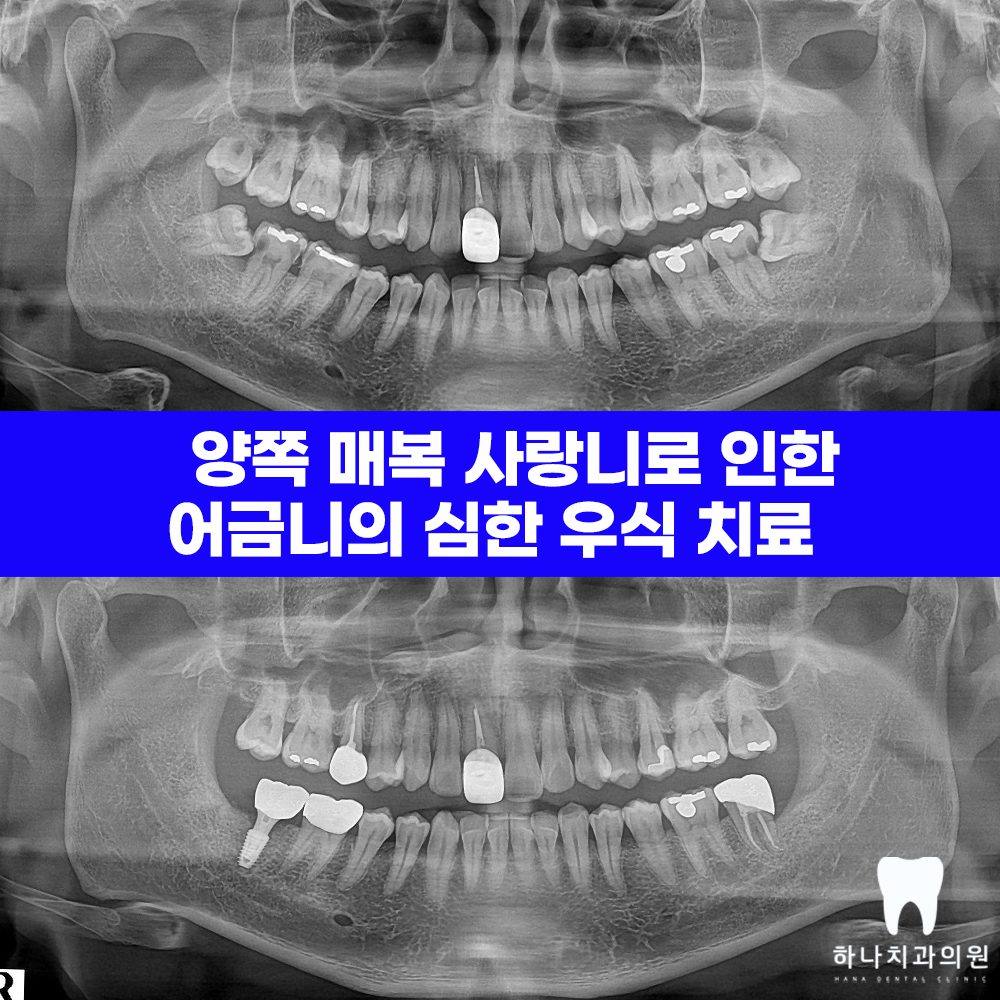 울산삼산동치과 