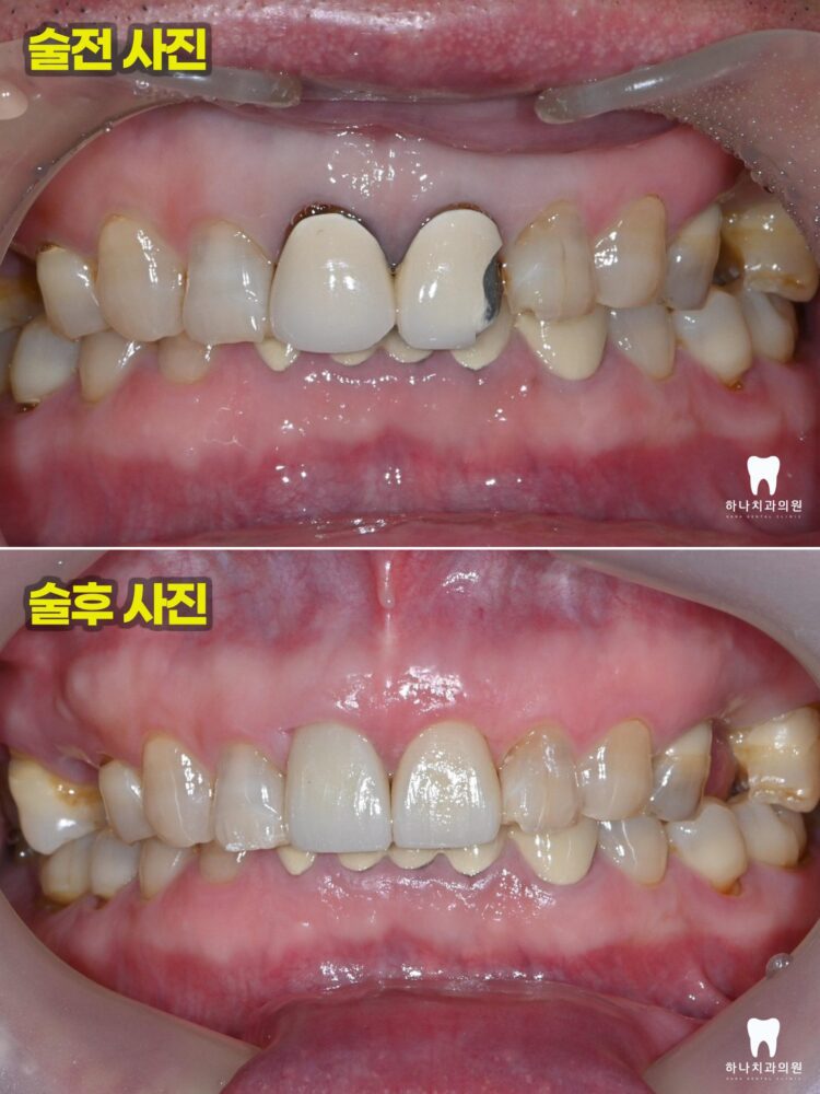 울산삼산동치과 