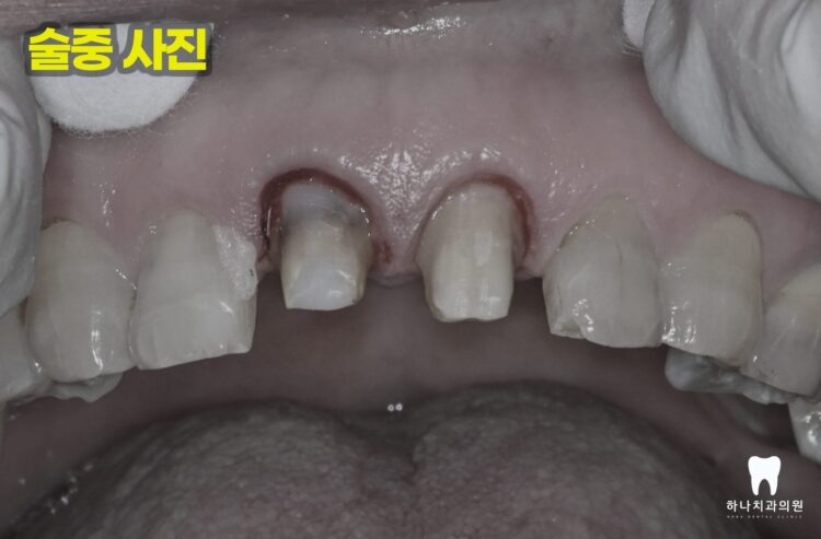 울산삼산동치과 