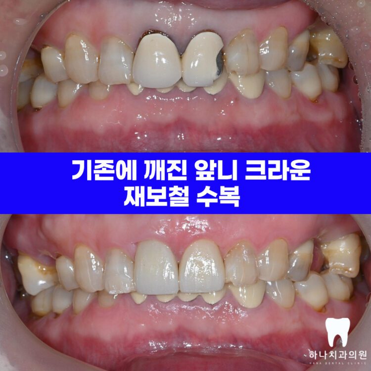 울산삼산동치과 